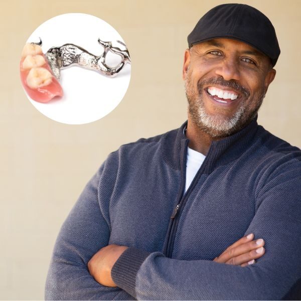 Partial dentures types and cost – smiling man with a cast metal partial denture in Guelph